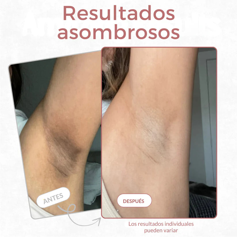 Kivana Peel Shot - Spray exfoliante corporal con ácido kójico y cúrcuma