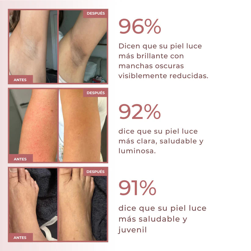 Kivana Peel Shot - Spray exfoliante corporal con ácido kójico y cúrcuma