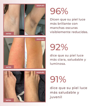 Kivana Peel Shot - Spray exfoliante corporal con ácido kójico y cúrcuma